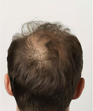Scalp Reset & Reboot Duo