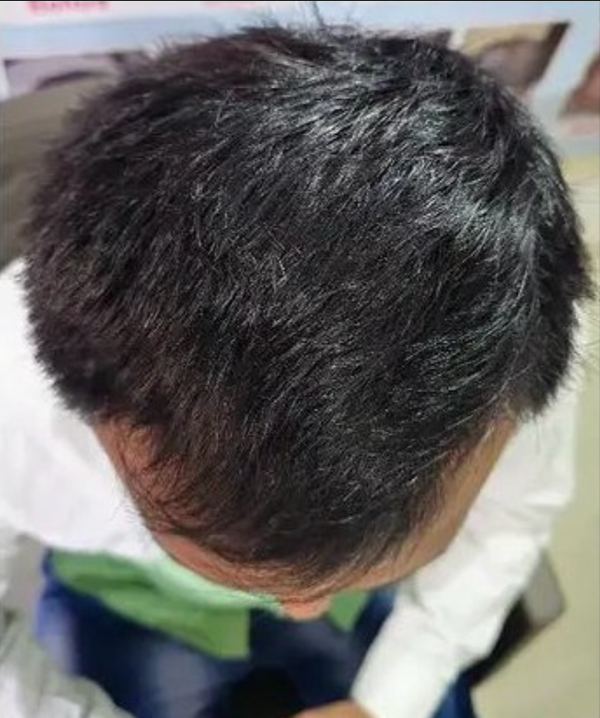 Scalp Reset & Reboot Duo