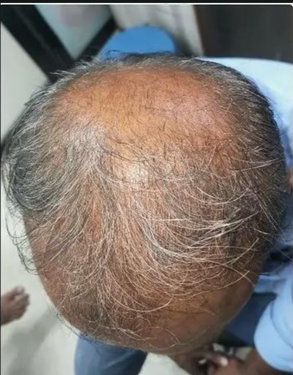 Scalp Reset & Reboot Duo