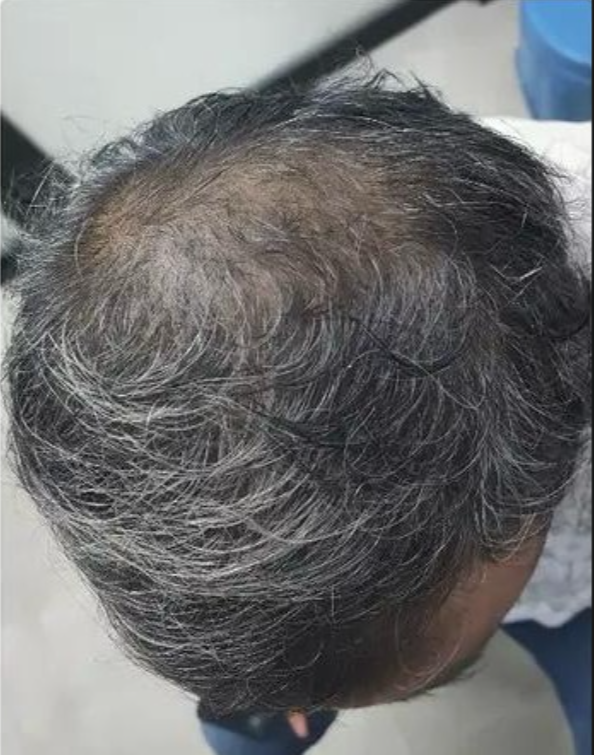 Scalp Reset & Reboot Duo