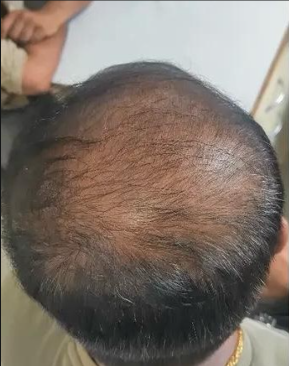 Scalp Reset & Reboot Duo