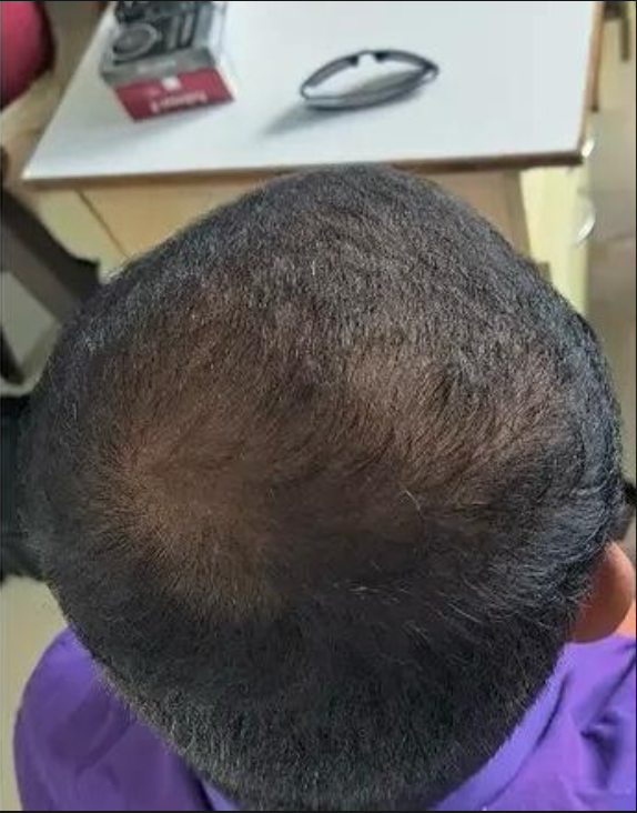 Scalp Reset & Reboot Duo