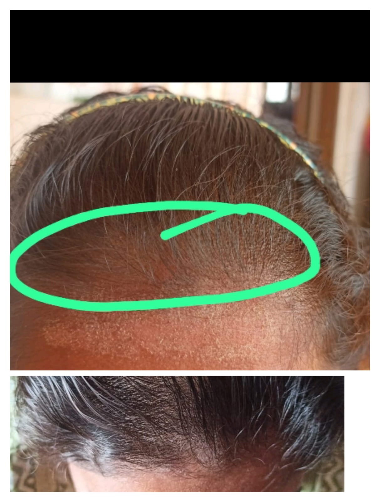 Scalp Reset Serum & Scalp Reboot Hair Oil Combo