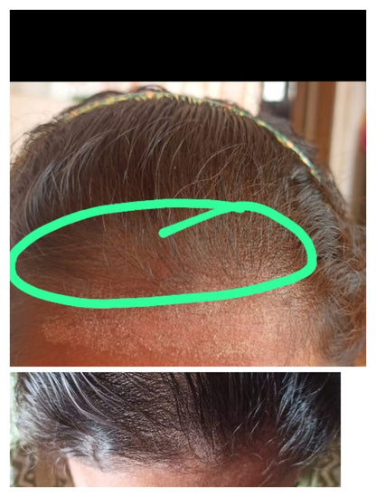 Scalp Reset Serum & Scalp Reboot Hair Oil Combo