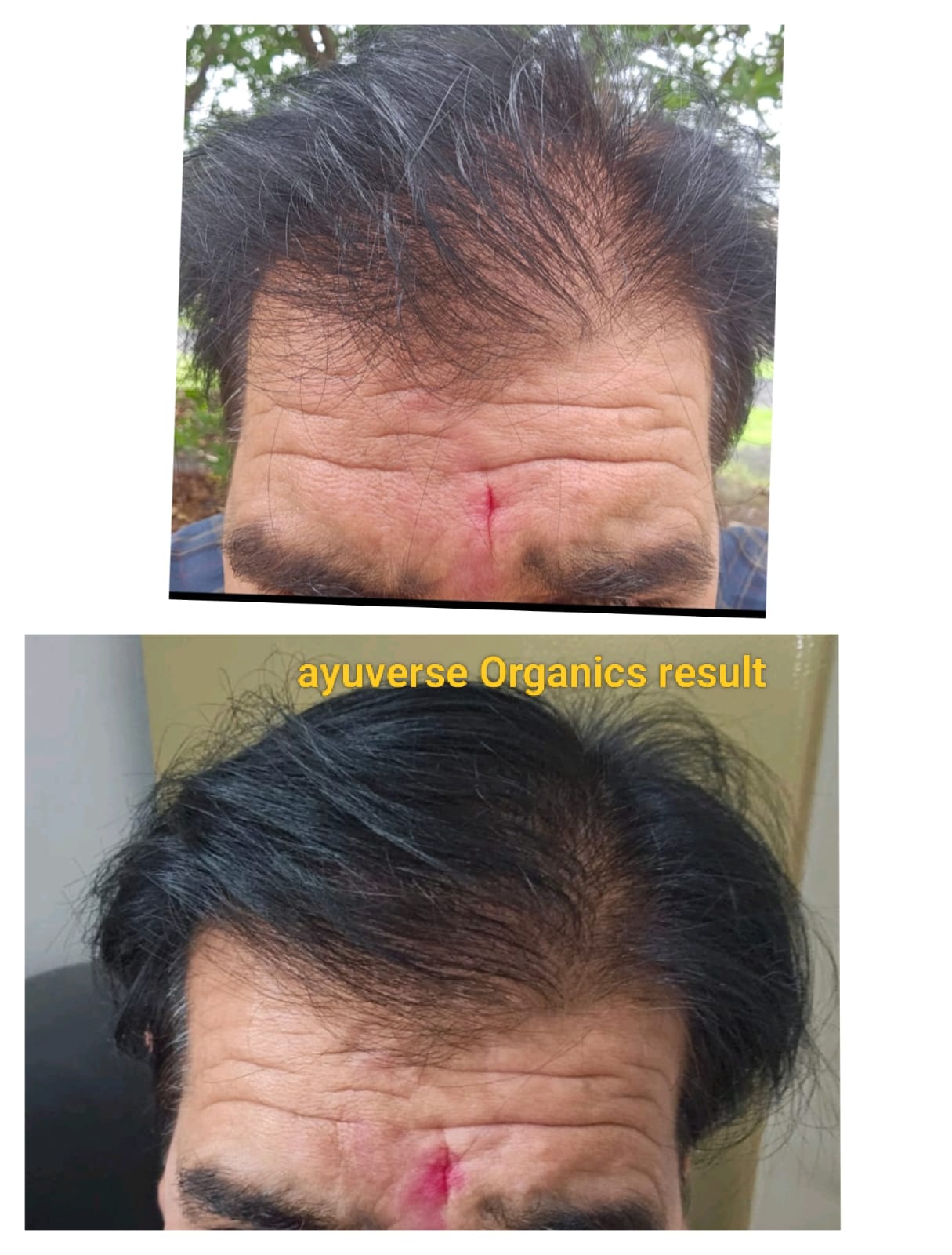 Scalp Reset Serum & Scalp Reboot Hair Oil Combo