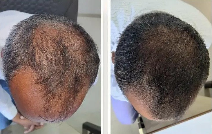 Scalp Reset Serum & Scalp Reboot Hair Oil Combo